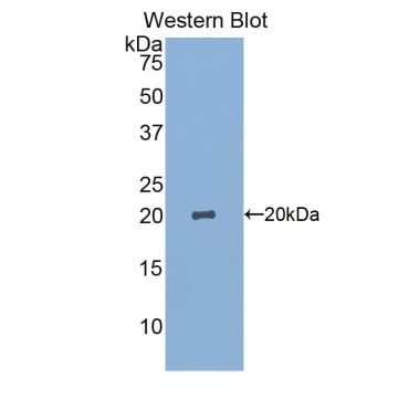 Sialic Acid Binding Ig Like Lectin 14 (SIGLEC14) Human Polyclonal Antibody