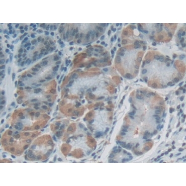 Filaggrin 2 (FLG2) Human Polyclonal Antibody