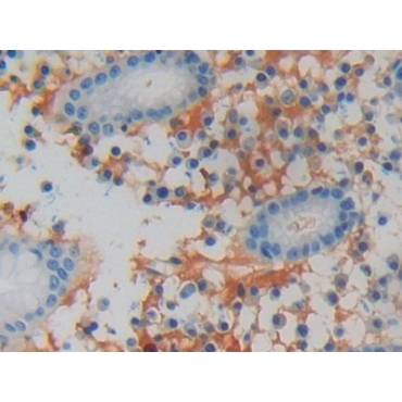 Lipocalin 15 (LCN15) Human Polyclonal Antibody