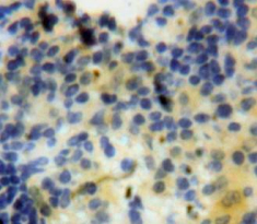 Vascular Endothelial Growth Factor 145 (VEGF145) Mouse Polyclonal Antibody