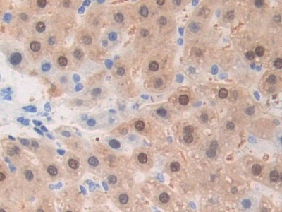 A Disintegrin And Metalloprotease 1 (ADAM1) Rat Polyclonal Antibody