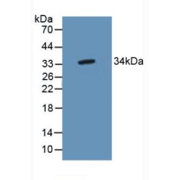 TP53 Target Gene 5 (TP53TG5) Human Polyclonal Antibody