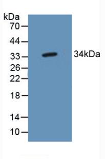 TP53 Target Gene 5 (TP53TG5) Human Polyclonal Antibody
