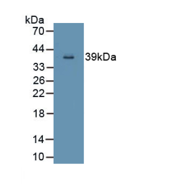 NADH Dehydrogenase 5 (ND5) Human Polyclonal Antibody