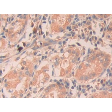 Ribonuclease A11 (RNASE11) Human Polyclonal Antibody