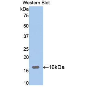 Ribonuclease A12 (RNASE12) Human Polyclonal Antibody