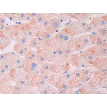 Galectin 9B (GAL9B) Human Polyclonal Antibody