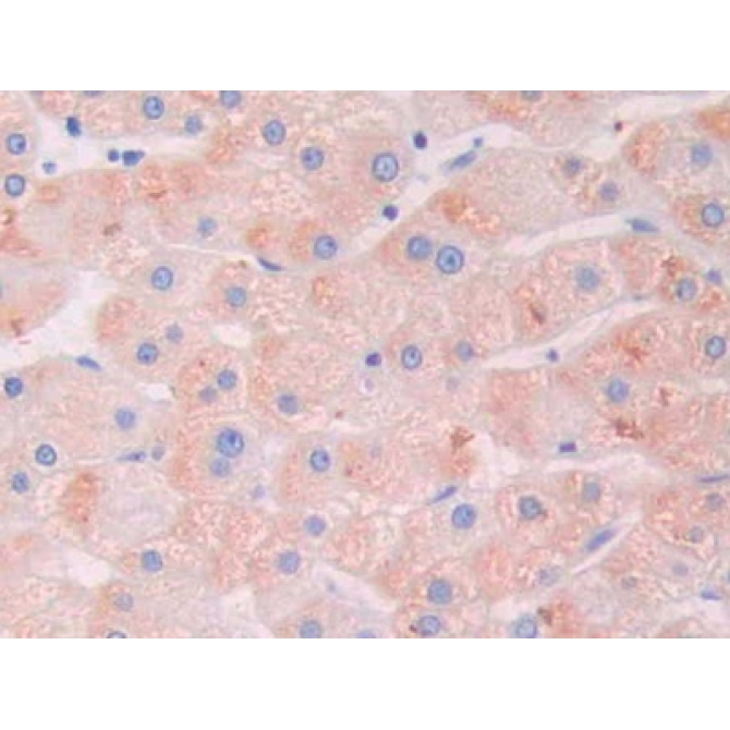 Galectin 9B (GAL9B) Human Polyclonal Antibody