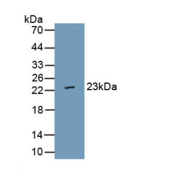 Von Willebrand Factor A Domain Containing Protein 5B2 (vWA5B2) Human Polyclonal Antibody
