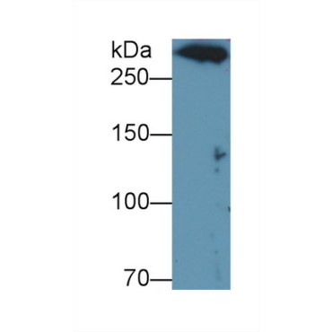 Dynein Heavy Chain Domain Containing Protein 1 (DNHD1) Human Polyclonal Antibody