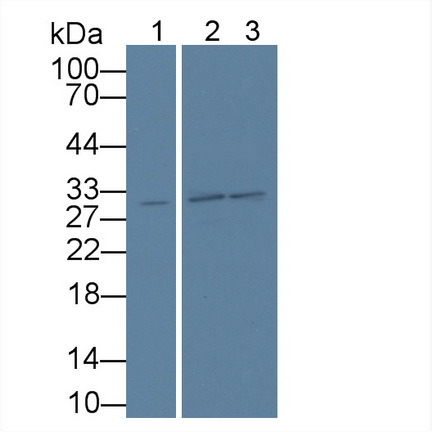 WD Repeat Containing Domain Protein 90 (WDR90) Human Polyclonal Antibody