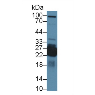 Shisa Homolog 4 (SHISA4) Human Polyclonal Antibody