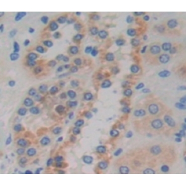 Coiled Coil Domain Containing Protein 60 (CCDC60) Human Polyclonal Antibody