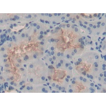 Family With Sequence Similarity 132, Member A (FAM132A) Human Polyclonal Antibody