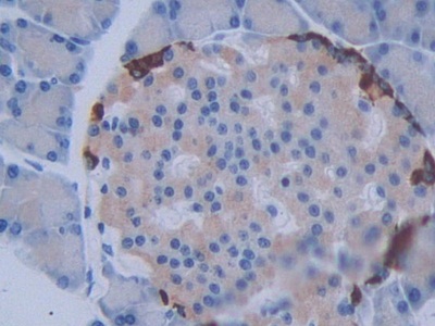 Methyltransferase Like Protein 21C (METTL21C) Rat Polyclonal Antibody