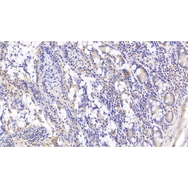 Galectin 9C (GAL9C) Human Polyclonal Antibody