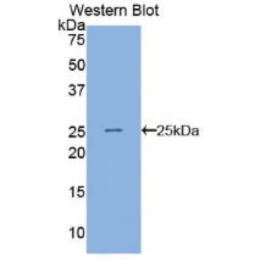 Angiopoietin Like Protein 8 (ANGPTL8) Human Polyclonal Antibody