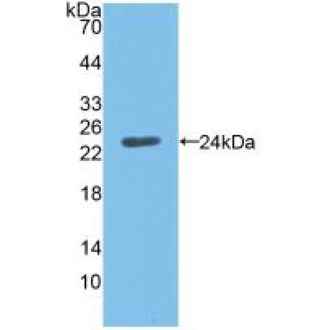 Angiopoietin Like Protein 8 (ANGPTL8) Mouse Polyclonal Antibody