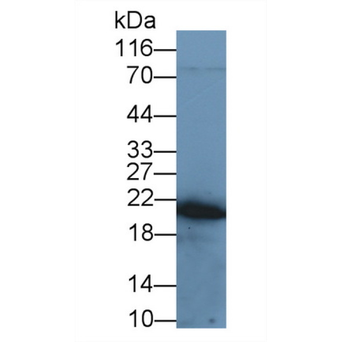 Tumor Necrosis Factor Alpha (TNFa) Human Recombinant Antibody