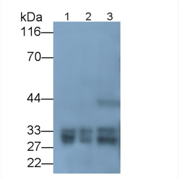 Cardiac Troponin I (cTnI) Human Recombinant Antibody