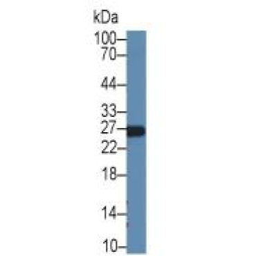 Apolipoprotein A1 (APOA1) Human Recombinant Antibody