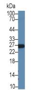 Apolipoprotein A1 (APOA1) Human Recombinant Antibody