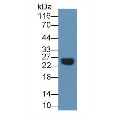 C Reactive Protein (CRP) Human Recombinant Antibody