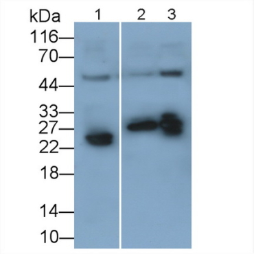 C Reactive Protein (CRP) Human Recombinant Antibody
