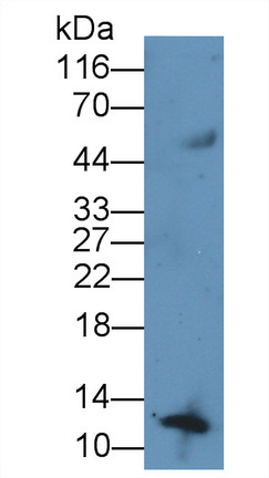 Serum Amyloid A (SAA) Human Recombinant Antibody