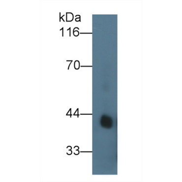 Procollagen I N-Terminal Propeptide (PINP) Human Recombinant Antibody