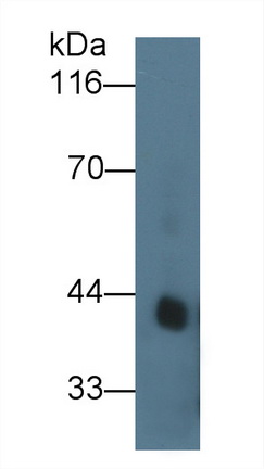 Procollagen I N-Terminal Propeptide (PINP) Human Recombinant Antibody