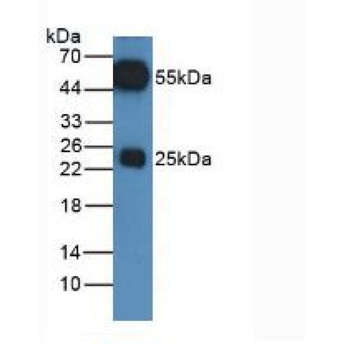 Equus caballus, Equine (Horse) HRP-Linked Rabbit Anti-Equine IgG Polyclonal Antibody