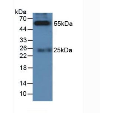 Felis catus, Feline (Cat) HRP-Linked Rabbit Anti-Feline IgG Polyclonal Antibody