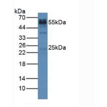 Chicken (Gallus) HRP-Linked Rabbit Anti-Gallus IgG Polyclonal Antibody
