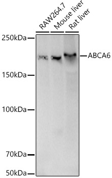 ABCA6 Rabbit Polyclonal Antibody [KD Validated]