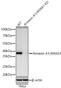 Annexin A1/ANXA1 Rabbit Monoclonal Antibody [KD Validated]