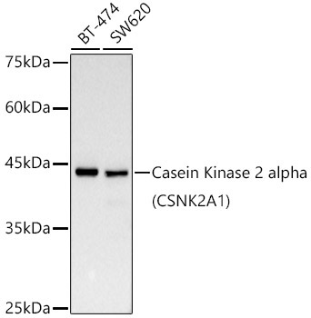 Casein Kinase 2 alpha (CSNK2A1) Rabbit Monoclonal Antibody [KD Validated]