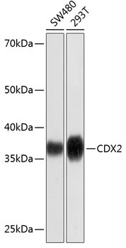 CDX2 Rabbit Monoclonal Antibody [KD Validated]