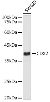 CDX2 Rabbit Monoclonal Antibody [KD Validated]