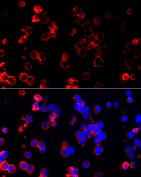 CLIC1 Rabbit Polyclonal Antibody [KD Validated]
