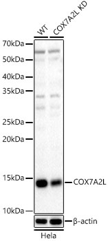 COX7A2L Rabbit Polyclonal Antibody [KD Validated]