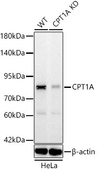 CPT1A Rabbit Monoclonal Antibody [KD Validated]