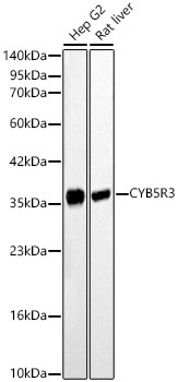 CYB5R3 Rabbit Polyclonal Antibody [KD Validated]