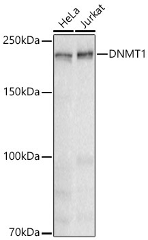 DNMT1 Rabbit Monoclonal Antibody [KD Validated]