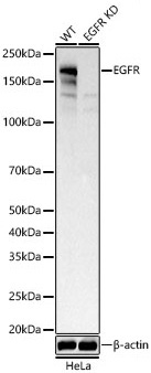 EGFR Rabbit Monoclonal Antibody [KD Validated]