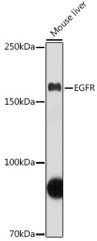 EGFR Rabbit Polyclonal Antibody [KD Validated]
