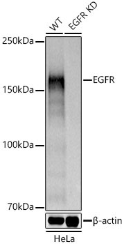 EGFR Rabbit Polyclonal Antibody [KD Validated]