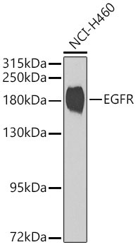 EGFR Rabbit Polyclonal Antibody [KD Validated]