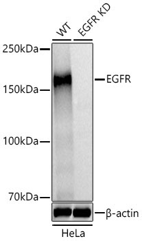 EGFR Rabbit Polyclonal Antibody [KD Validated]