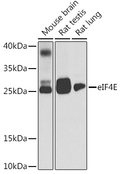 eIF4E Rabbit Polyclonal Antibody [KD Validated]